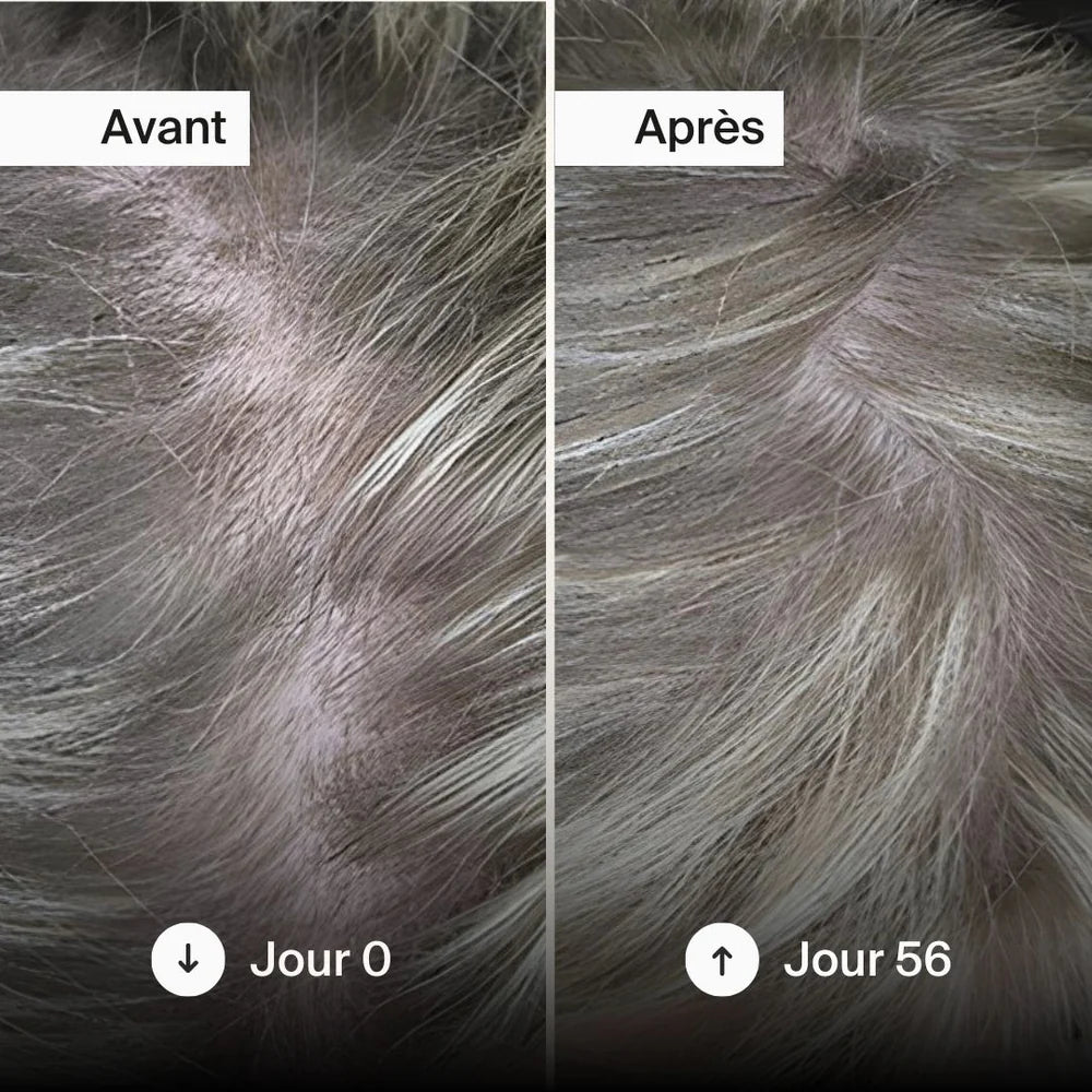 Cheveux - Naali | NutriHeart